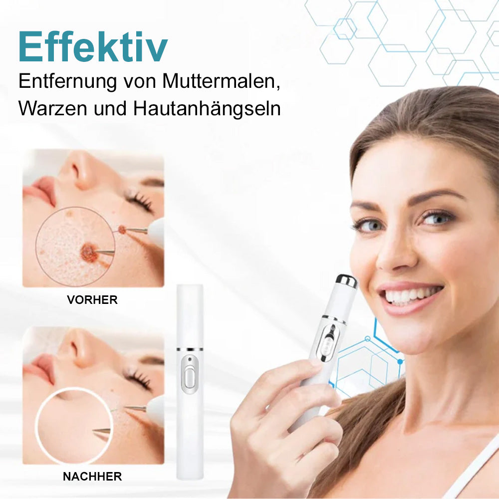💙Bikenda® Nicht-invasiver Laser-Stift für Muttermale und Warzen – Schmerzfrei, narbenfrei, sicher | Dermatologisch geprüft