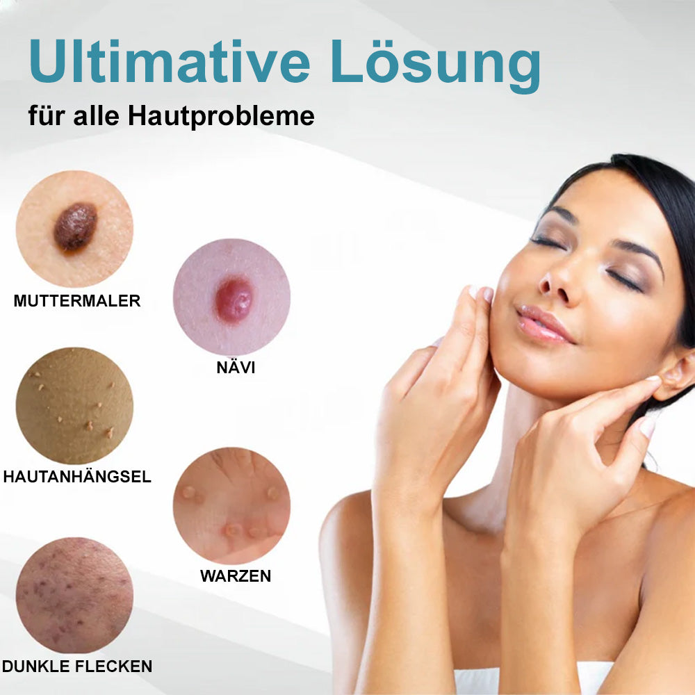 💙Bikenda® Nicht-invasiver Laser-Stift für Muttermale und Warzen – Schmerzfrei, narbenfrei, sicher | Dermatologisch geprüft