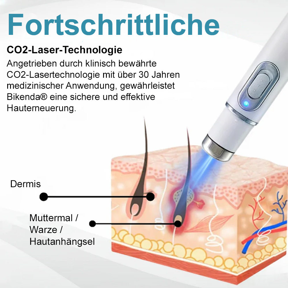 💙Bikenda® Nicht-invasiver Laser-Stift für Muttermale und Warzen – Schmerzfrei, narbenfrei, sicher | Dermatologisch geprüft