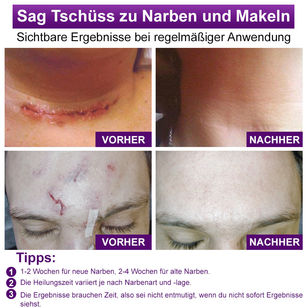 ✅flysmus® cure GESICHTS- & KÖRPER-NARBENGEL