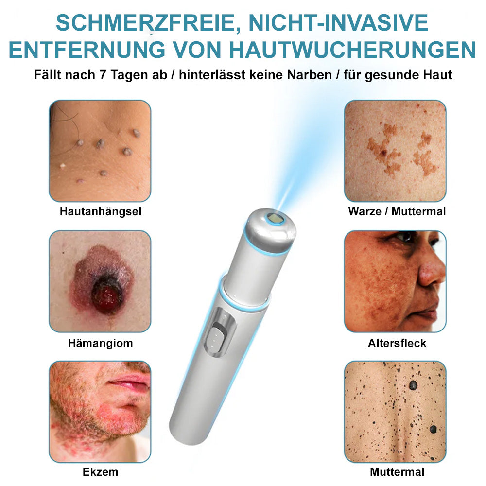 💙Bikenda® Nicht-invasiver Laser-Stift für Muttermale und Warzen – Schmerzfrei, narbenfrei, sicher | Dermatologisch geprüft
