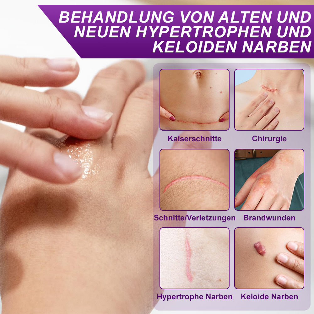 ✅flysmus® cure GESICHTS- & KÖRPER-NARBENGEL