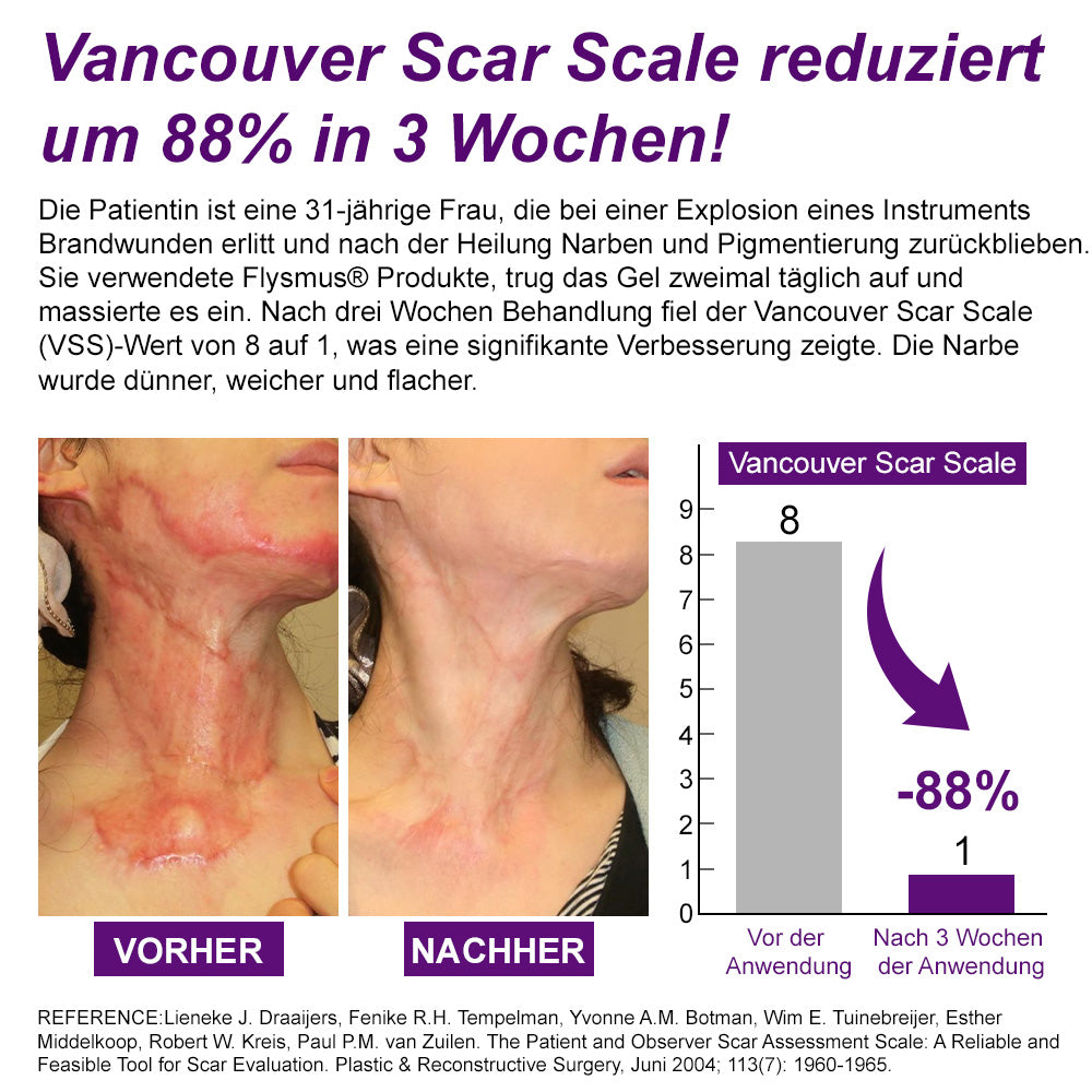 ✅flysmus® cure GESICHTS- & KÖRPER-NARBENGEL