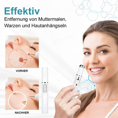💙Bikenda® Nicht-invasiver Laser-Stift für Muttermale und Warzen – Schmerzfrei, narbenfrei, sicher | Dermatologisch geprüft