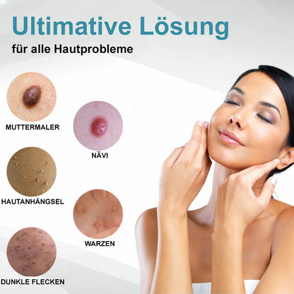 💙Bikenda® Nicht-invasiver Laser-Stift für Muttermale und Warzen – Schmerzfrei, narbenfrei, sicher | Dermatologisch geprüft