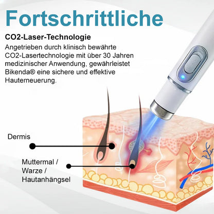 💙Bikenda® Nicht-invasiver Laser-Stift für Muttermale und Warzen – Schmerzfrei, narbenfrei, sicher | Dermatologisch geprüft