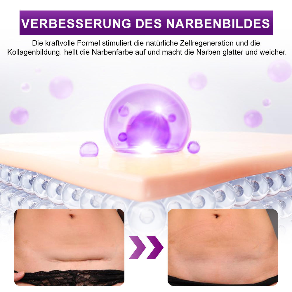💙BfArM-ZERTIFIZIERT ✅flysmus® cure GESICHTS- & KÖRPER-NARBENGEL – Klinisch erwiesen, verschiedene Narben wie OP-, Akne-, Verbrennungs- und Unfallnarben zu mildern.
